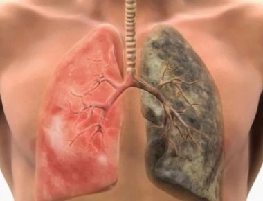 Αυτές οι 6 τροφές καθαρίζουν τα πνευμόνια σας από το τσιγάρο!